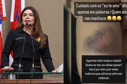 Deputada Alessandra Campelo denuncia lutador de MMA que agrediu ex namorada em Manaus tqP0tU