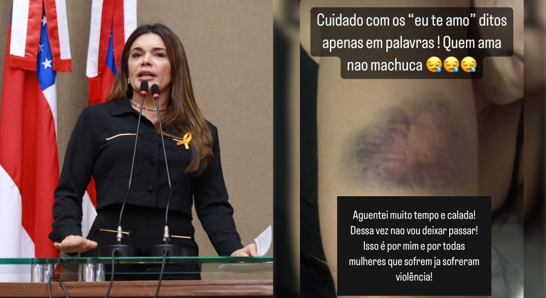 Deputada Alessandra Campelo denuncia lutador de MMA que agrediu ex namorada em Manaus tqP0tU