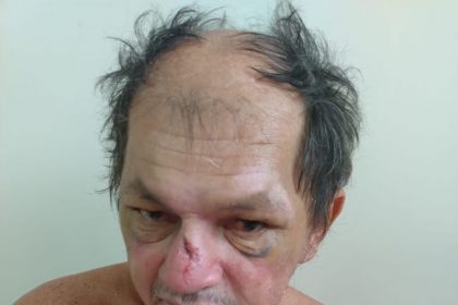SAUDE HPS JOAOLUCIO PROCURA FAMILIARES FOTO DIVULGACAO SES AM 766x1024 1