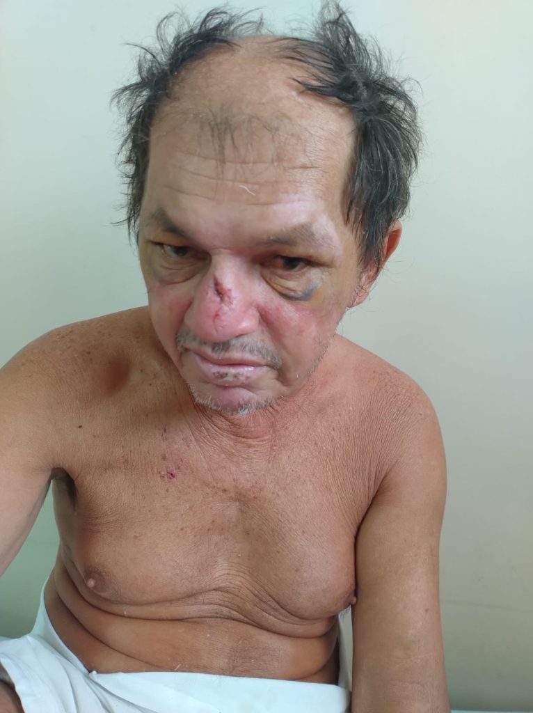 SAUDE HPS JOAOLUCIO PROCURA FAMILIARES FOTO DIVULGACAO SES AM 766x1024 1