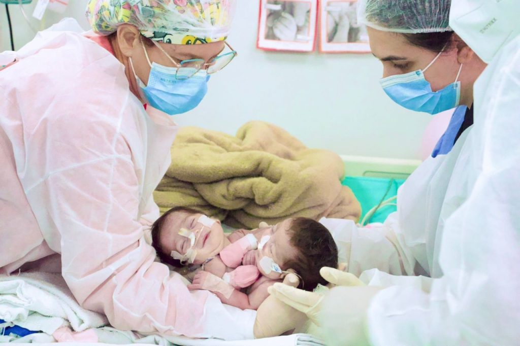Cirurgia de separação das gêmeas siamesas nascidas no Amazonas é bem-sucedida 9 9a07c879 1c2a 4ef4 99b4 048a30b206a9 1024x682 1