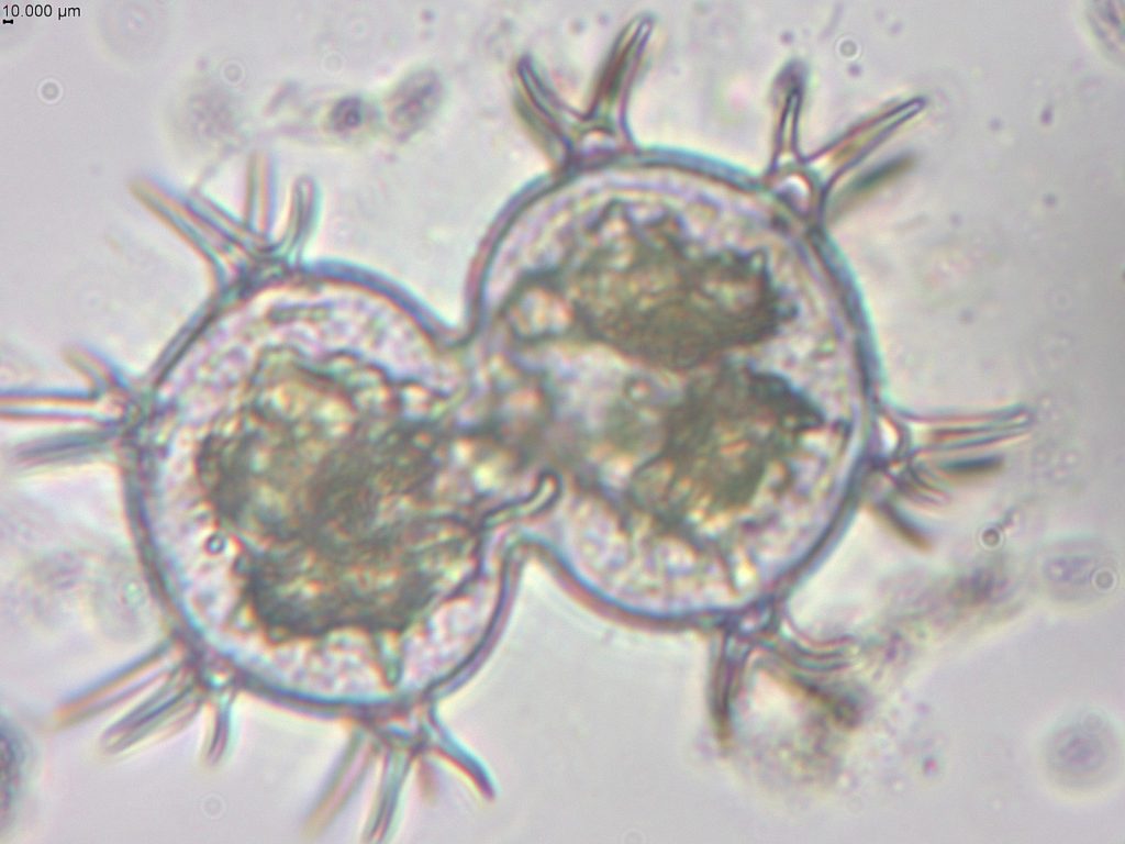 Com apoio do Governo do Amazonas, pesquisa identifica duzentas espécies de microalgas em Parintins 8 Fapeam Pesquisa identifica duzentas especies de microalgas em Parintins Foto arquivo da pesquisadora Angela Maria da Silva Lehmkuhl 3 1024x768 1