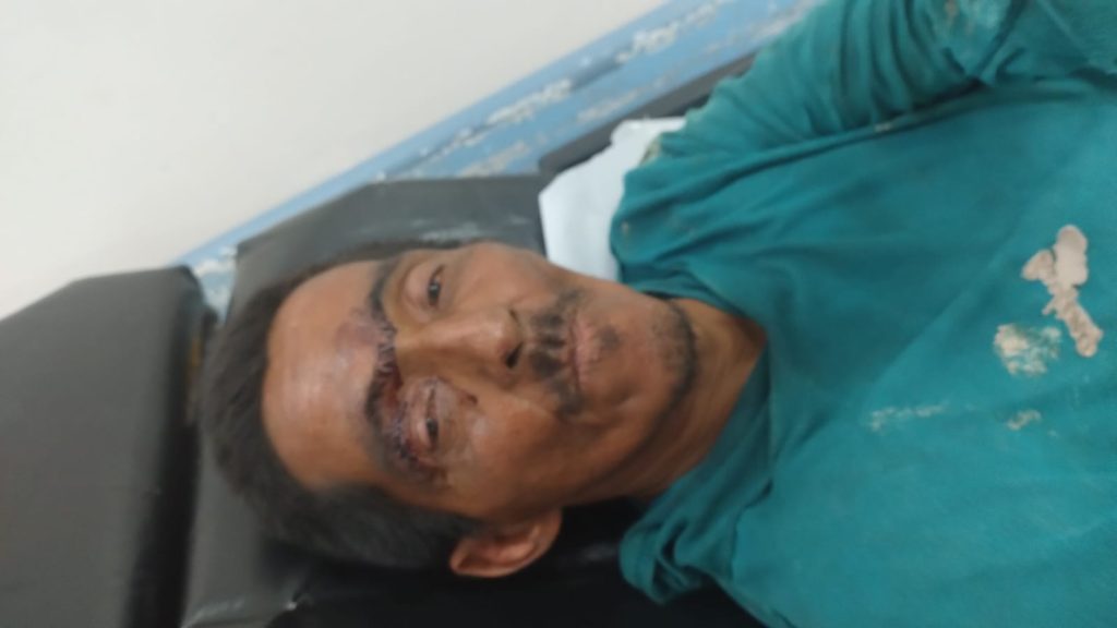 HPS João Lúcio pede ajuda para localizar familiares de um paciente que obteve alta hospitalar na unidade Informe Manaus SES AM PACIENTE RONALDO BRITTODE 1024x576 1